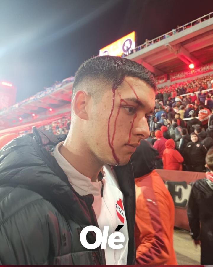 导致后者不 导致后者不